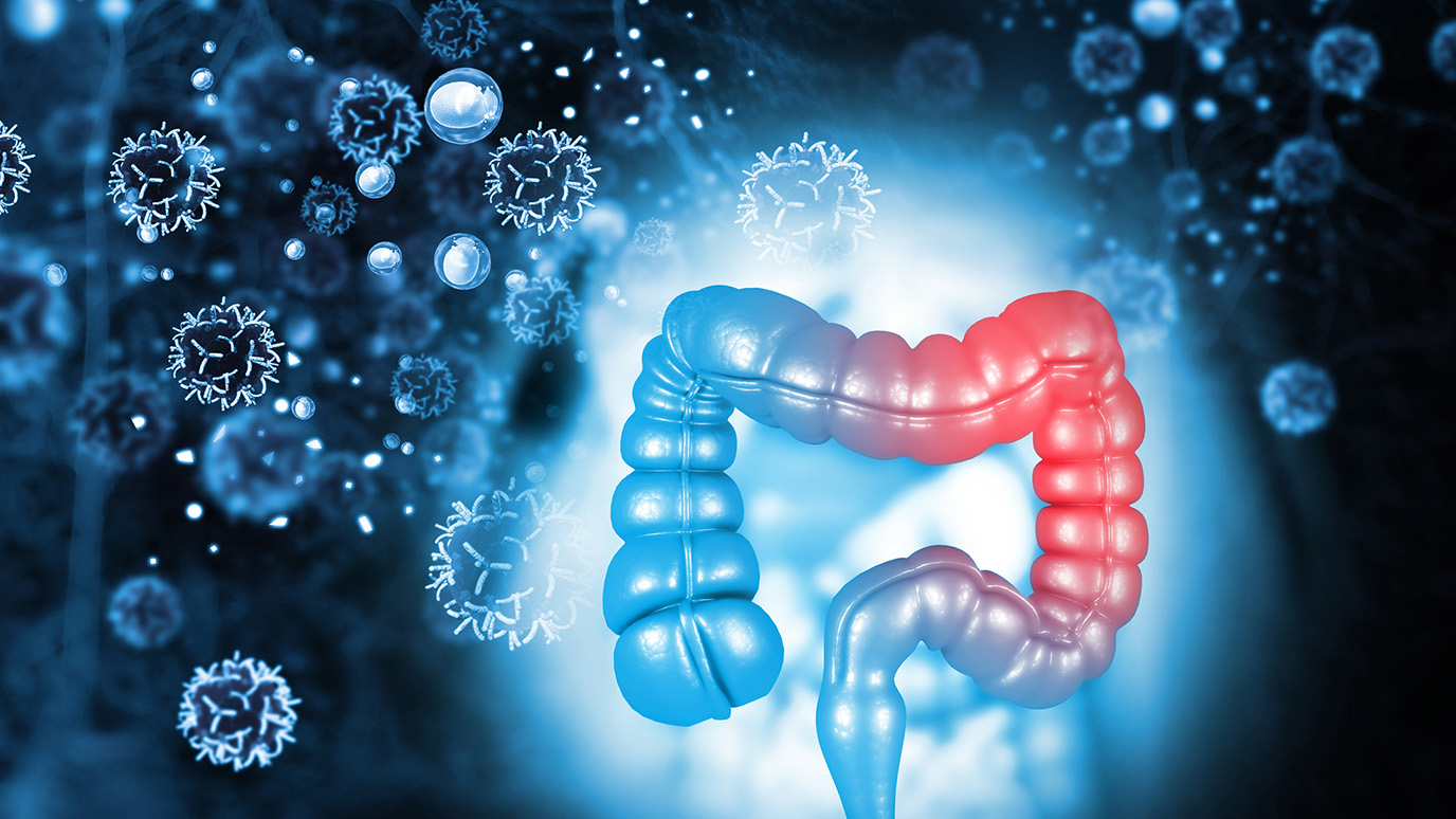 Patients With Refractory Metastatic Colorectal Cancer Experience